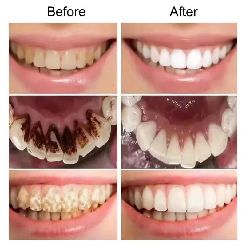 V34 Purple Teeth Whitening Toothpaste – Plaque Removal, Stain Cleaning, and Fresh Breath for a Brighter Smile