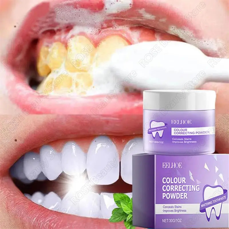 5 Days Teeth Whitening Powder – Removes Plaque, Stains & Dental Calculus for a Brighter, Fresher Smile