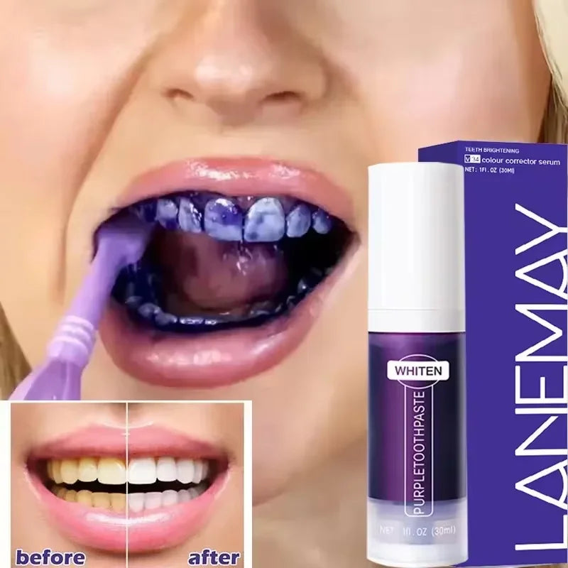 V34 Purple Teeth Whitening Toothpaste – Plaque Removal, Stain Cleaning, and Fresh Breath for a Brighter Smile