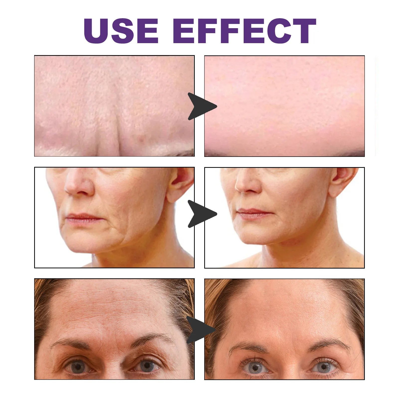 100Pcs Facial Wrinkle Patch Cheek Lift Stickers Smooth Fine Lines Reduce Nasolabial Fold Tighten The Skin Facial Care Products