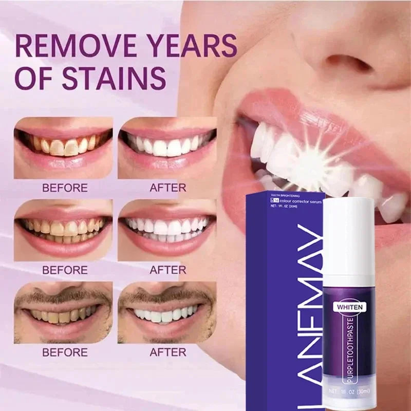 V34 Purple Teeth Whitening Toothpaste – Plaque Removal, Stain Cleaning, and Fresh Breath for a Brighter Smile