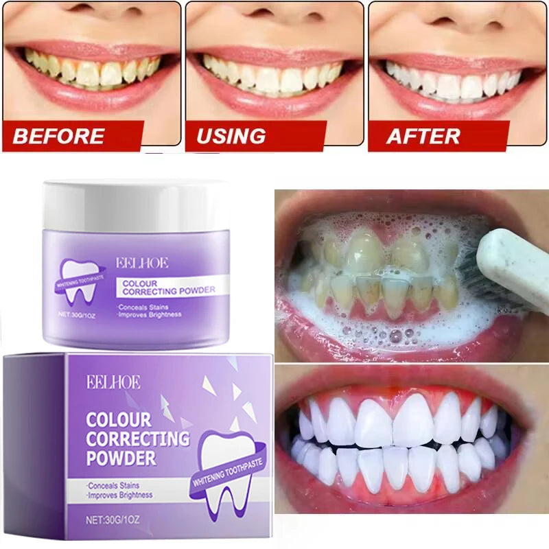 5 Days Teeth Whitening Powder – Removes Plaque, Stains & Dental Calculus for a Brighter, Fresher Smile